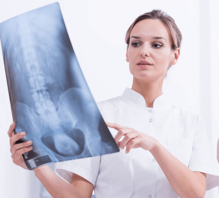 Diagnosticul osteocondrozei toracice prin examinare cu raze X