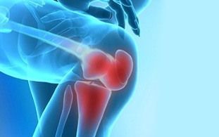 modul în care se manifestă artroza articulației genunchiului
